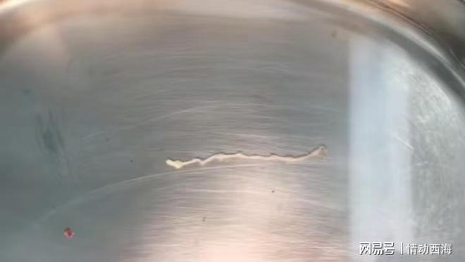 脑袋里面一条虫男子吃完牛蛙火锅后不幸中招：牛蛙一定要烫熟(图2)